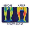 Foot Circulation Plus (FSA or HSA Eligible) - Medic Foot Massager Machine